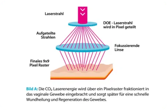 Bild-A.png