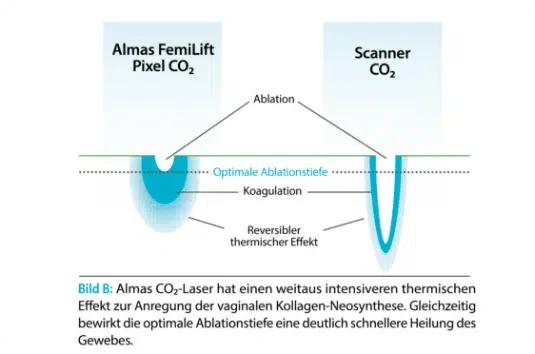 Bild-B.png